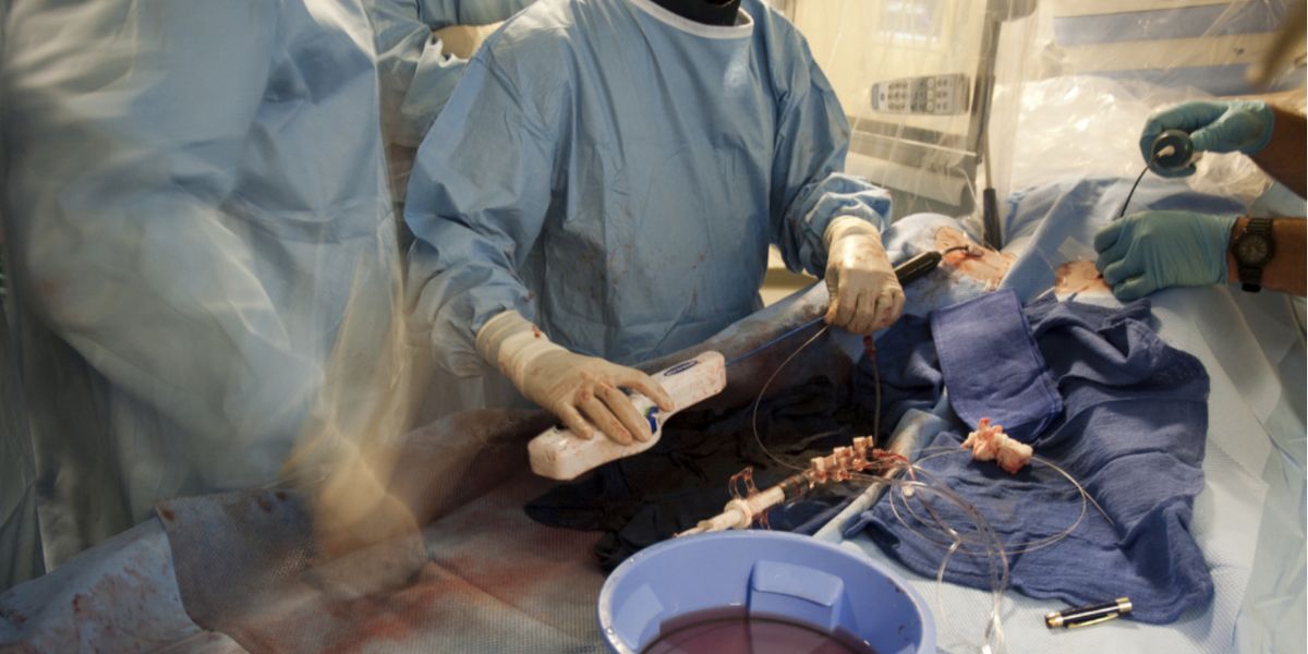 Cardiac Surgery Devices